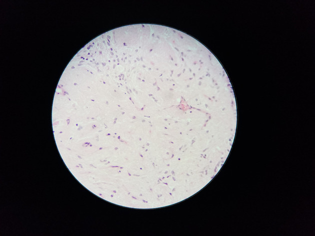 Pituitary Gland Slides - Pituitary Gland 007 400X